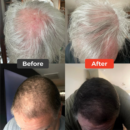 Defix Hair ReGen Cap